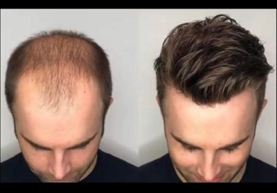 Mens hair system application in person course - Premium courses from Millionaire Beauty Brand Extensions - Just $1500.00! Shop now at Millionaire Beauty Brand Extensions 